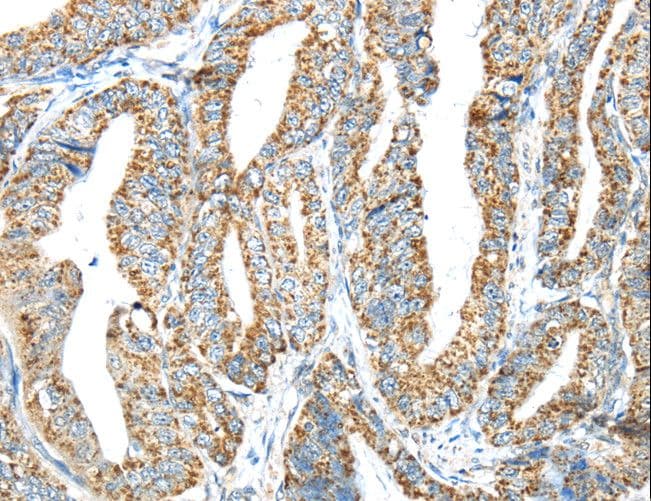 IFNA2 / Interferon Alpha 2 Antibody