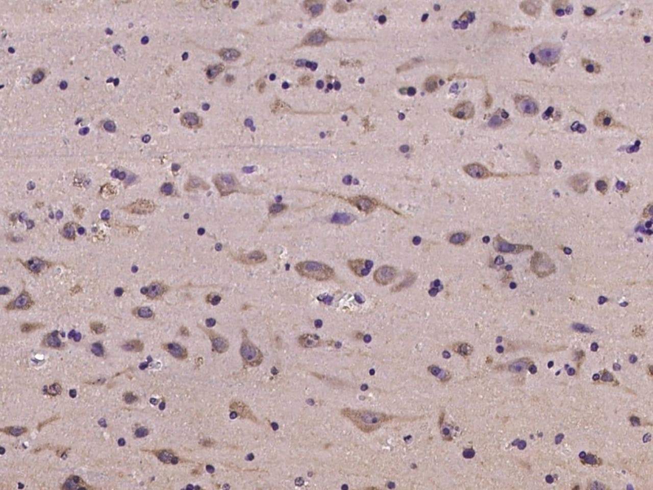 NMT2 Antibody