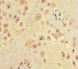 SCG2 / Secretogranin II Antibody
