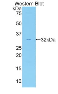 MYO1C Antibody (aa728-987)