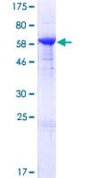 Human PLEK / Pleckstrin Protein (Recombinant GST)