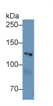 MYO1E / Myosin IE Antibody (aa772-1033, APC)