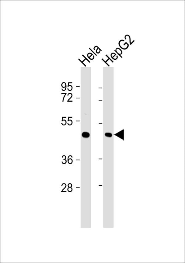 ATXN10 / SCA10 Antibody