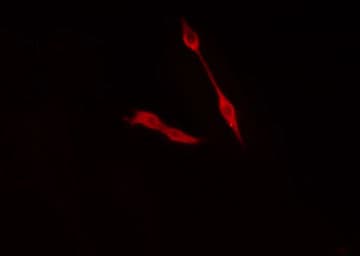 TRIP4 / ASC-1 Antibody