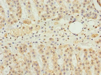 NBR1 Antibody