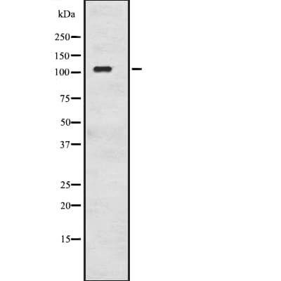 ADCY8 / Adenylate Cyclase 8 Antibody