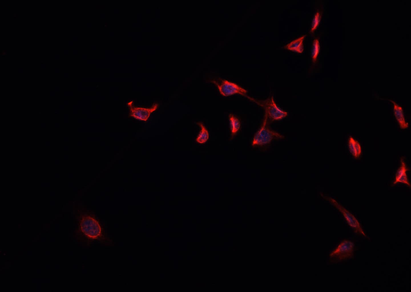 FOXO4 / AFX1 Antibody