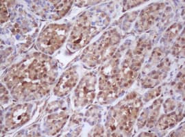 IDH1 / IDH Antibody (clone OTI1D1)