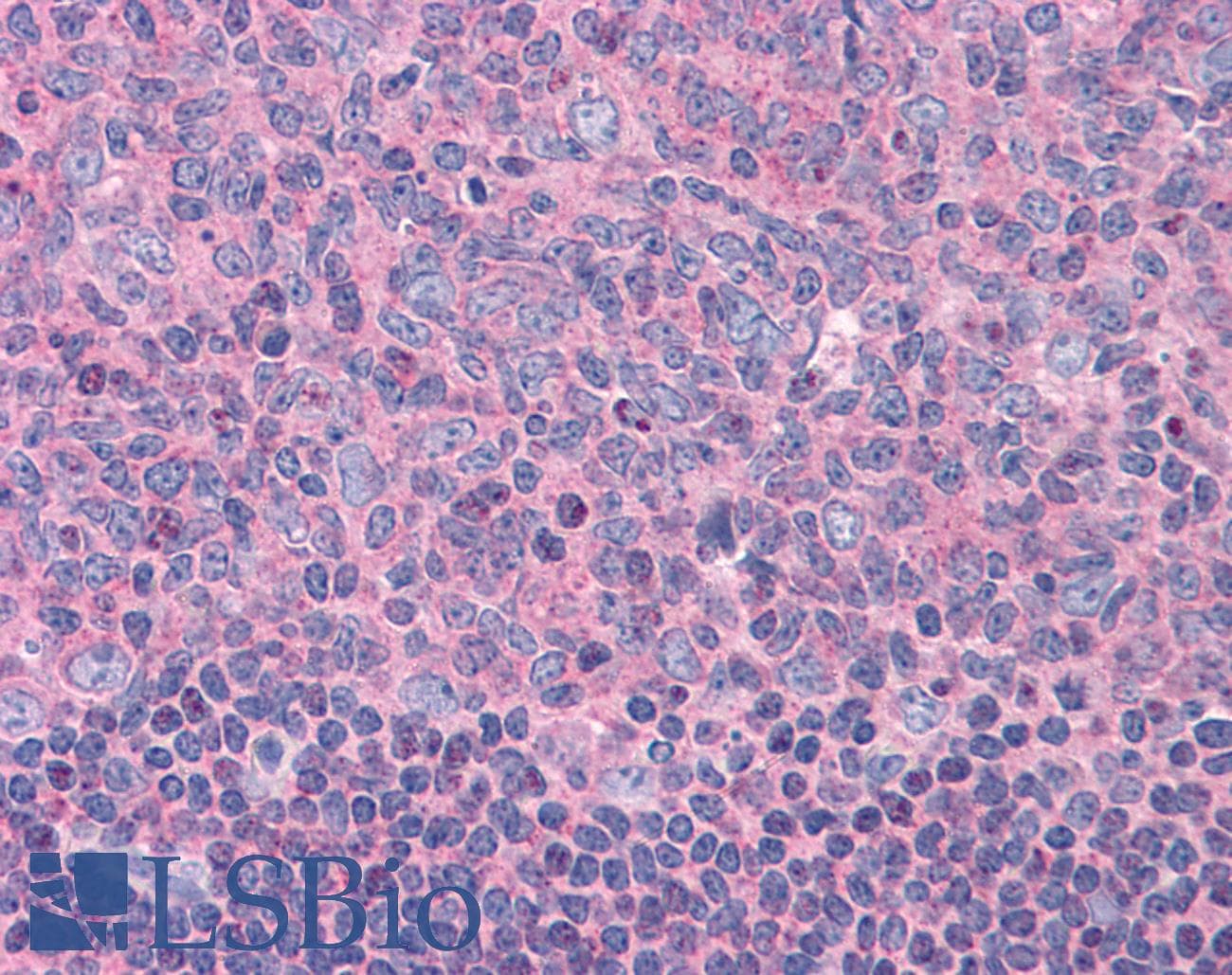 IHC-plus™ ELP3 Antibody