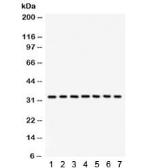 Polyclonal Rabbit anti-Human CDK2 Antibody (IHC, WB)