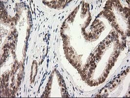 PRKCE / PKC-Epsilon Antibody (clone OTI4B3, Carrier-free)