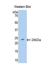 IFNA5 / Interferon Alpha 5 Antibody (aa22-189)