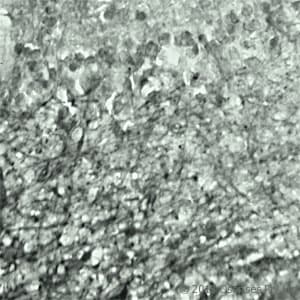 Polyclonal Rabbit anti-Human SYT17 Antibody (Internal, IHC, WB)