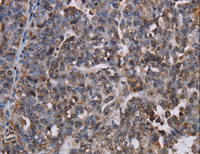 LBR / Lamin B Receptor Antibody