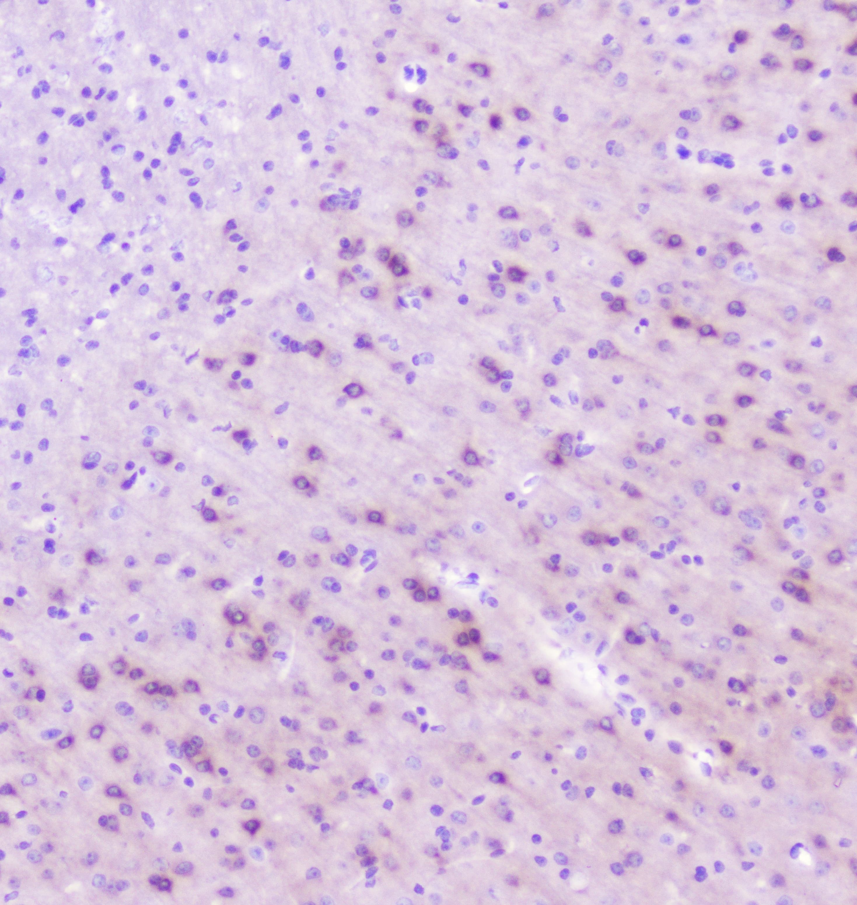 RASAL1 / RASAL Antibody
