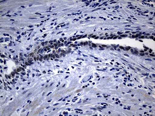 UPRT Antibody (clone OTI1D11, Carrier-free)