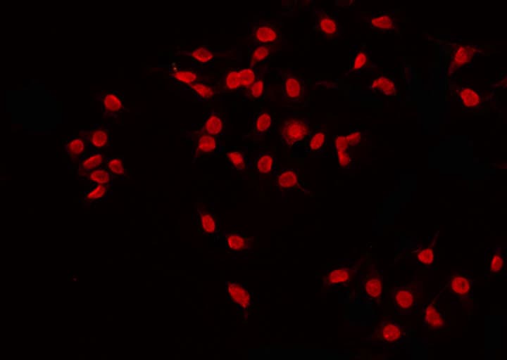 MGMT Antibody