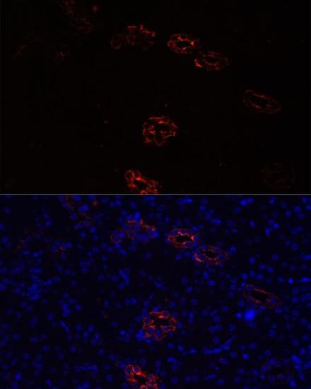 AQP2 / Aquaporin 2 Antibody