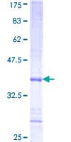 Human PHKA2 Protein (Recombinant GST, N-terminus)