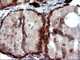 UPRT Antibody (clone OTI2D1)
