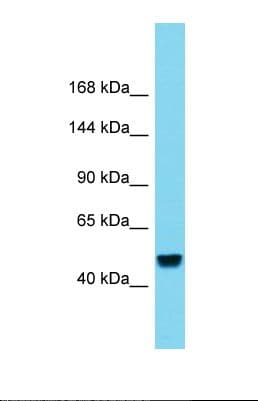 Polyclonal Rabbit anti-Human RBL2 / RB2 p130 Antibody (C-Terminus, WB)