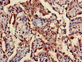 TPST1 Antibody