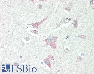 IHC-plus™ CHRNA10 Antibody (aa179-206)