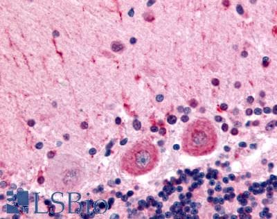 IHC-plus™ CELSR3 Antibody (C-Terminus)