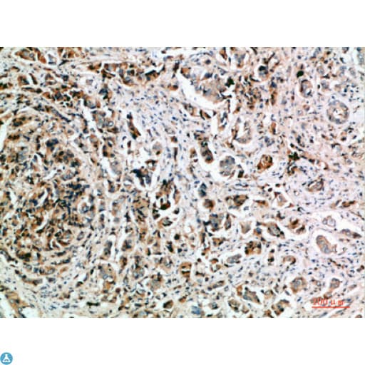 Polyclonal Rabbit anti-Human NANOS1 / NOS1 Antibody (WB)