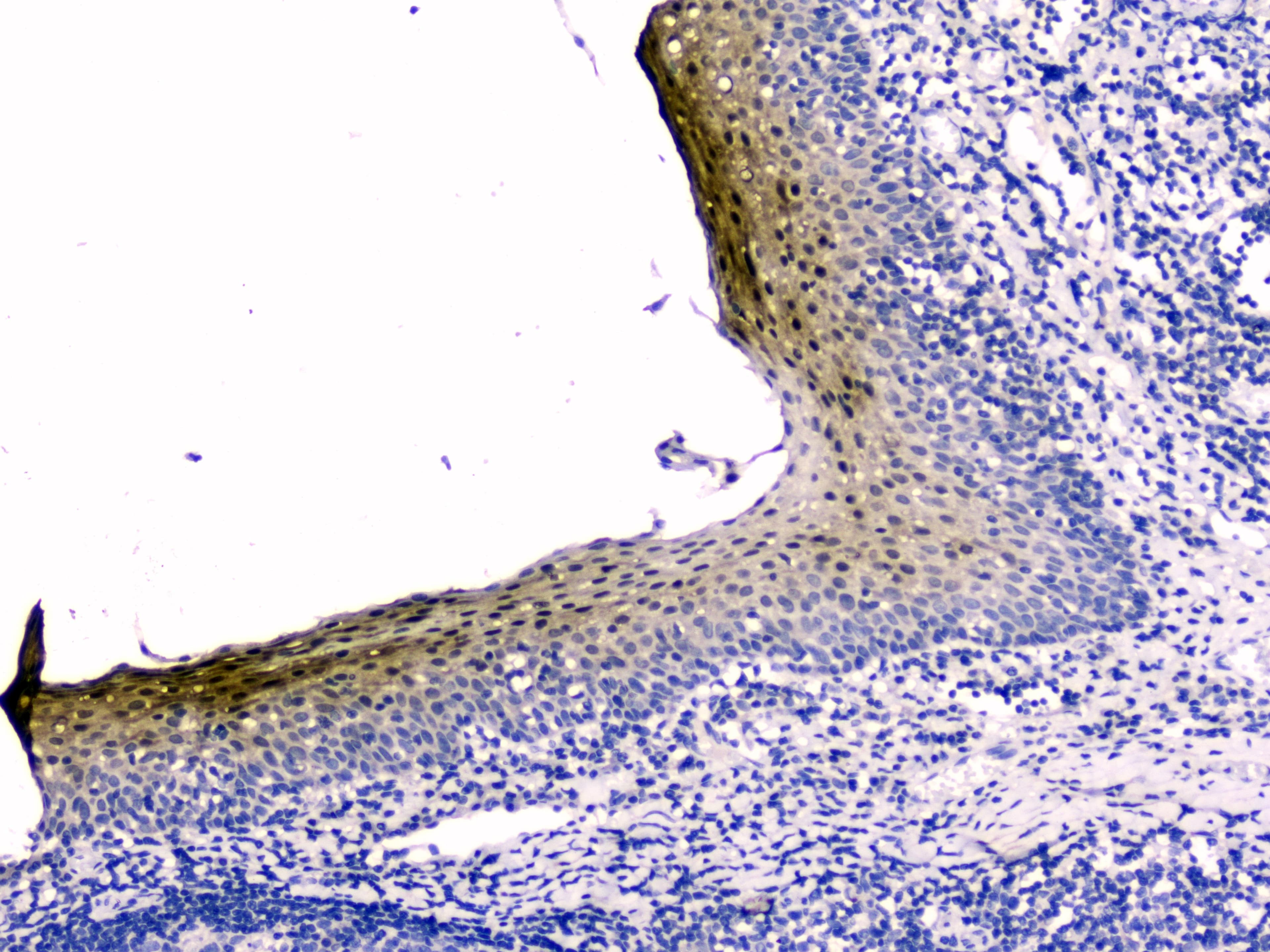 CSTB / Cystatin B / Stefin B Antibody