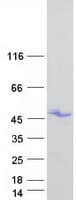 Human HOXB1 Protein (Recombinant Myc-DDK (Flag))