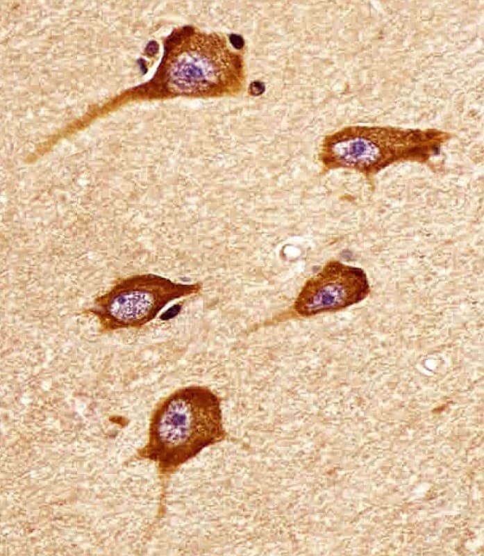 Polyclonal Rabbit anti-Human ATP2A3 / SERCA3 Antibody (aa13-47, IHC, WB)