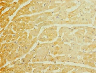 Polyclonal Rabbit anti-Human SCN7A Antibody (IHC, WB)