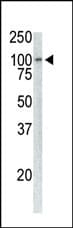 TPX2 Antibody (clone 19AT953.286.93)
