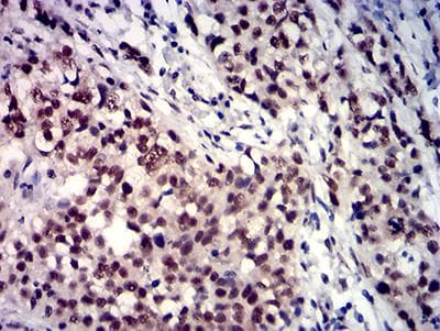 TBP / GTF2D Antibody (clone 7G11C8)