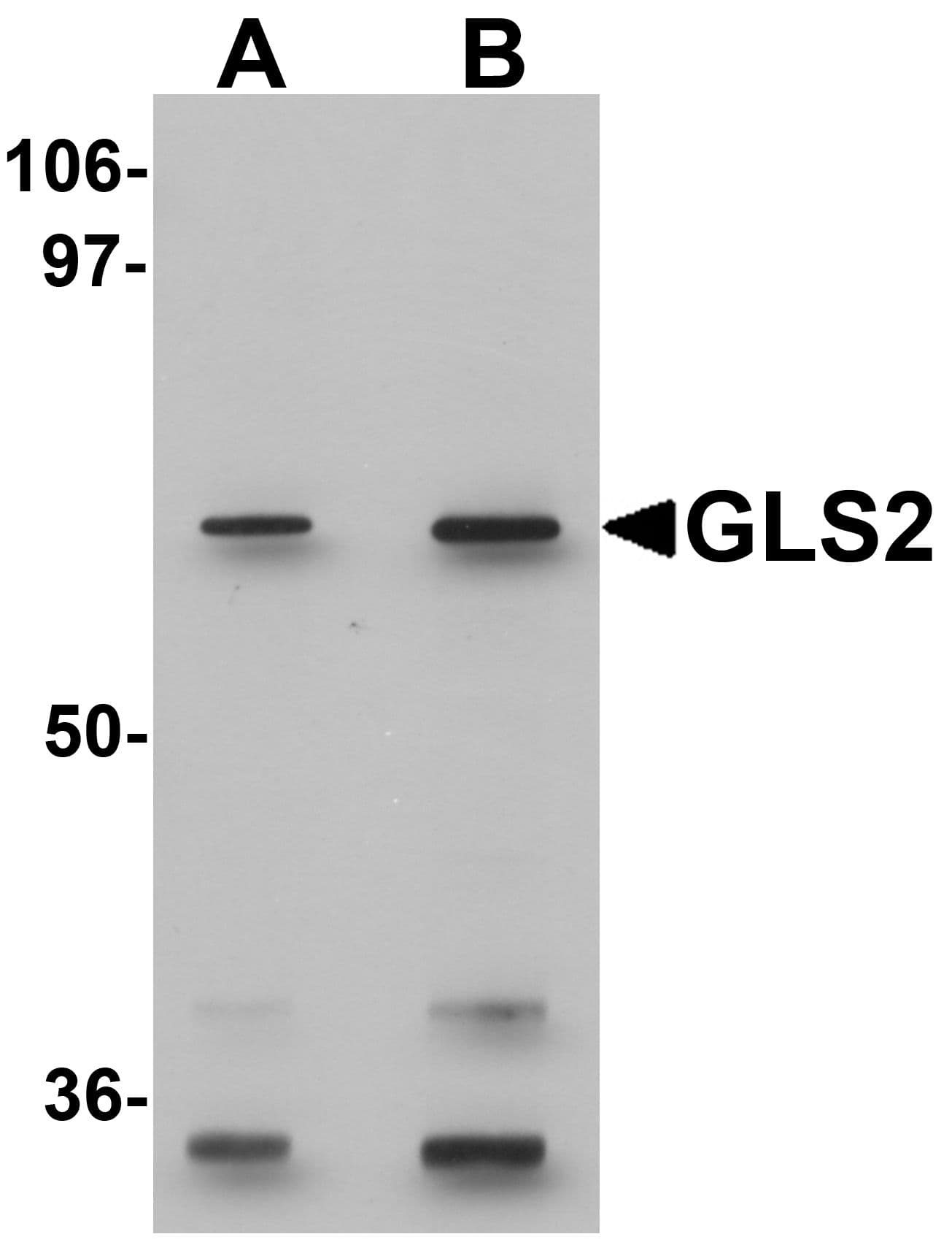 Polyclonal Rabbit anti-Human GLS2 / Glutaminase 2 Antibody (IHC, IF, WB)