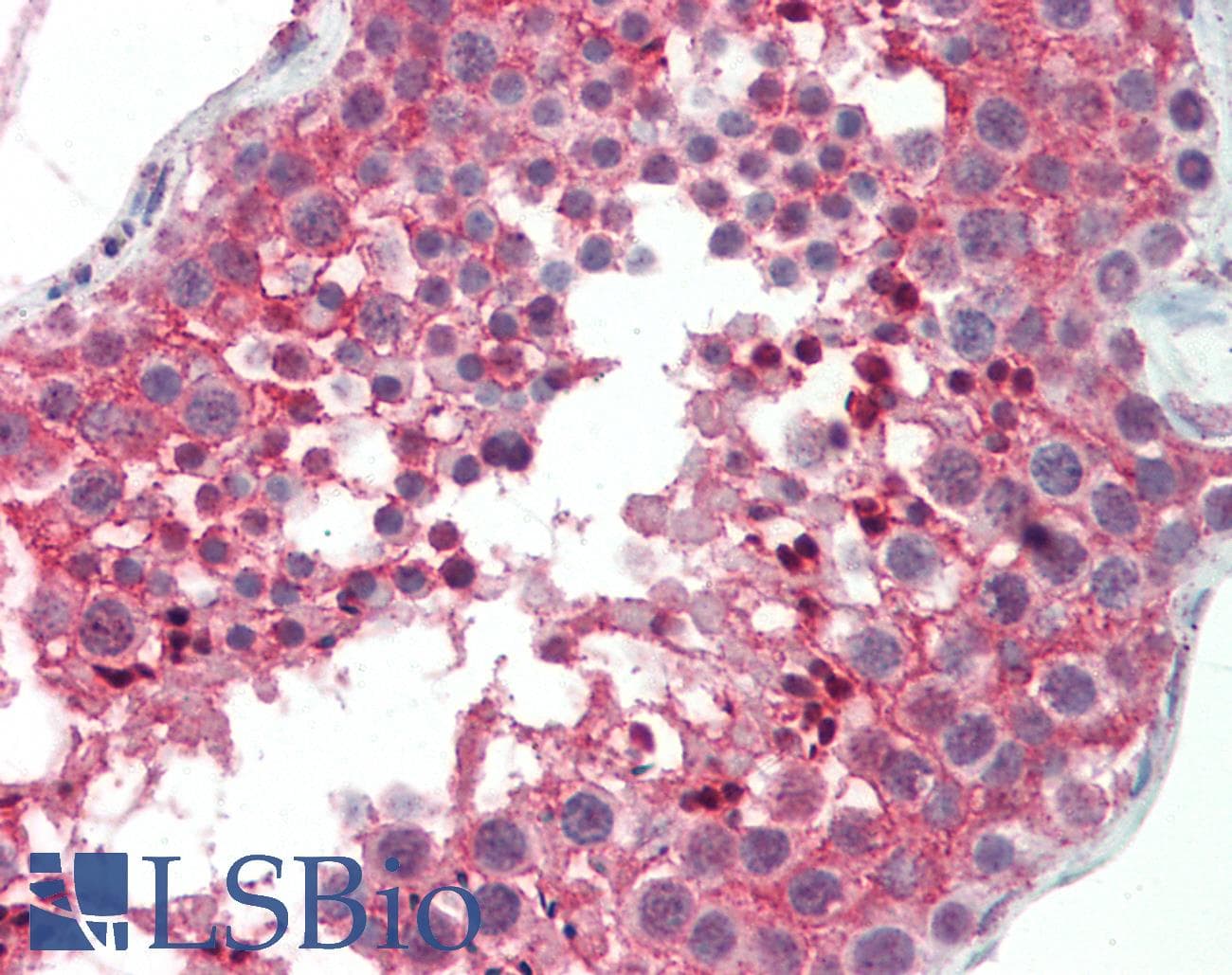CNOT3 Antibody (aa141-190)