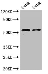 HTR3A / 5-HT3A Receptor Antibody