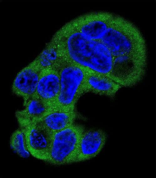 FGG / Fibrinogen Gamma Antibody (aa91-118)