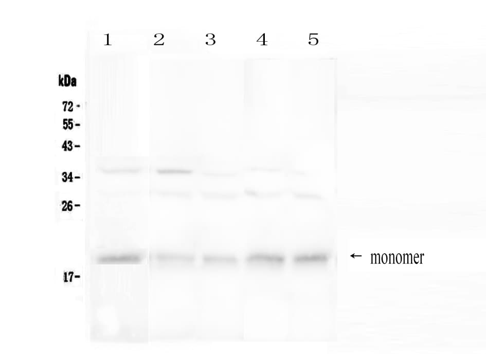 Polyclonal Rabbit anti-Human BAFF Receptor / CD268 Antibody (WB)