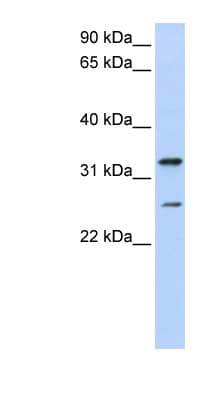KCNIP2 / KCHIP2 Antibody (aa72-121)