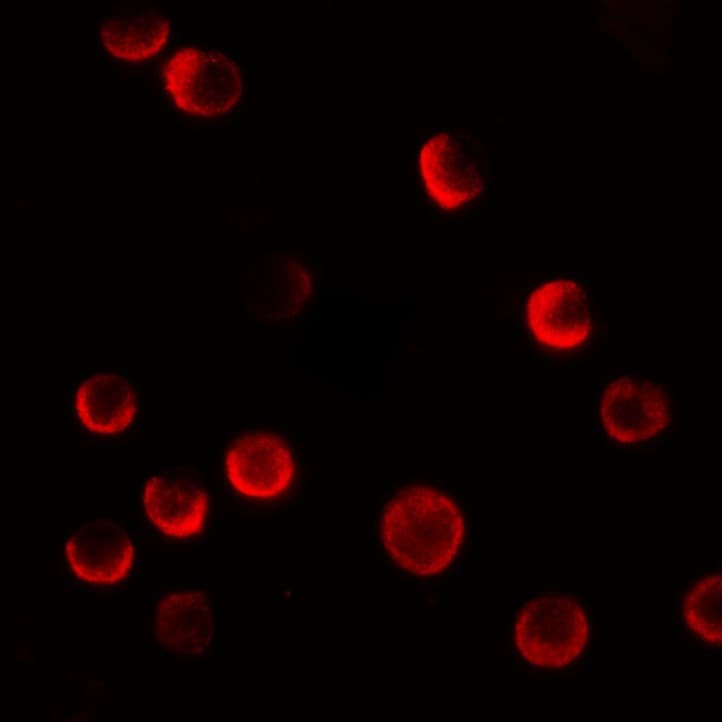 IHC-plus™ Polyclonal Rabbit anti-Human CASKIN2 Antibody (IHC, IF, WB)