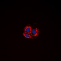 Polyclonal Rabbit anti-Human SNCA / Alpha-Synuclein Antibody (C-Terminus, IHC, IF, WB)