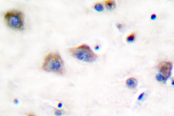 PTPN11 / SHP-2 / NS1 Antibody (phospho-Tyr580)
