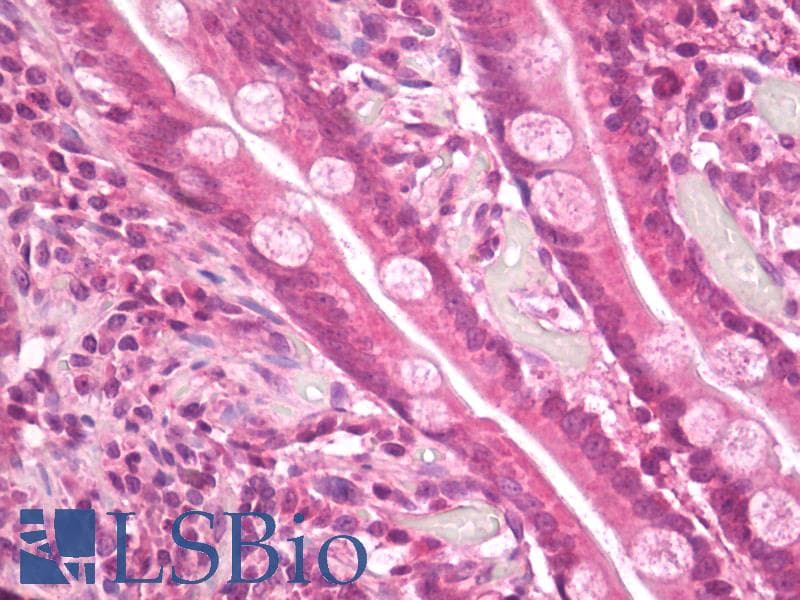 IHC-plus™ TRAIP / TRIP Antibody (aa328-356)