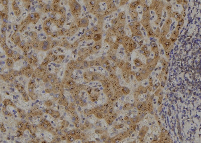 MAP3K14 Antibody