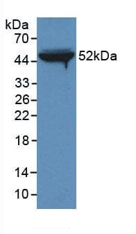 FGB / Fibrinogen Beta Chain Antibody (PE)