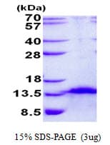 Human FDC-SP / C4orf7 Protein (Recombinant His)