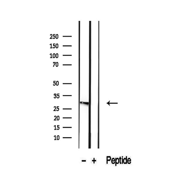 RAB12 Antibody