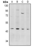 Polyclonal Rabbit anti-Human Acrosin Antibody (WB)